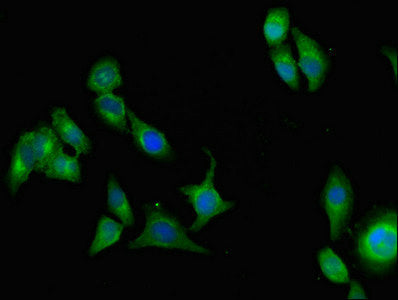 Immunofluorescent analysis of A549 cells using AOC3 Antibody at dilution of 1:100 and Alexa Fluor 488-congugated AffiniPure Goat Anti-Rabbit IgG(H+L)Rabbit anti-Human AOC3 Polyclonal Antibody