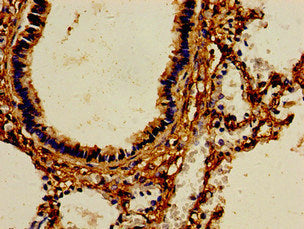 Immunohistochemistry of paraffin-embedded human lung tissue using AOC3 Antibody at dilution of 1:100Rabbit anti-Human AOC3 Polyclonal Antibody