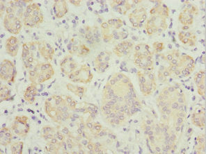 Immunohistochemistry of paraffin-embedded human salivary gland tissue using TPD52L1 Antibody at dilution of 1:100Rabbit anti-Human TPD52L1 Polyclonal Antibody