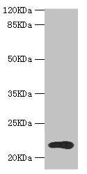 Western blot  | All lanes: TPD52L1 antibody at 1.31µg/ml + MCF-7 whole cell lysate  | Secondary  | Goat polyclonal to rabbit IgG at 1/10000 dilution  | Predicted band size: 23, 17, 15, 12, 20 kDa  | Observed band size: 23 kDaRabbit anti-Human TPD52L1 Polyclonal Antibody
