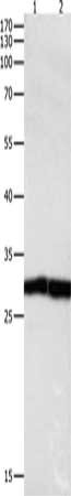 Gel: 10%SDS-PAGE, Lysate: 30 μg, Lane 1-2: Jurkat cells, human fetal kidney tissue, Primary antibody: DUSP6 Antibody(DUSP6 Antibody) at dilution 1/450, Secondary antibody: Goat anti rabbit IgG at 1/8000 dilution, Exposure time: 1 minuteRabbit anti-Human DUSP6 Polyclonal Antibody