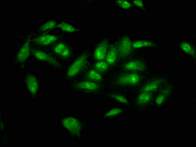 Immunofluorescence staining of Hela cells with NSUN2 Antibody at 1:66, counter-stained with DAPI. The cells were fixed in 4% formaldehyde, permeabilized using 0.2% Triton X-100 and blocked in 10% normal Goat Serum. The cells were then incubated with the antibody overnight at 4°C. The secondary antibody was Alexa Fluor 488-congugated AffiniPure Goat Anti-Rabbit IgG(H+L).Rabbit anti-Human NSUN2 Polyclonal Antibody