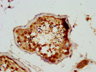 IHC image of NSUN2 Antibody diluted at 1:200 and staining in paraffin-embedded human testis tissue performed on a Leica BondTM system. After dewaxing and hydration, antigen retrieval was mediated by high pressure in a citrate buffer (pH 6.0). Section was blocked with 10% normal goat serum 30min at RT. Then primary antibody (1% BSA) was incubated at 4°C overnight. The primary is detected by a biotinylated secondary antibody and visualized using an HRP conjugated SP system.Rabbit anti-Human NSUN2 Polyclonal Antibody