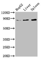 Western Blot | Positive WB detected in: HepG2 whole cell lysate, Rat liver tissue, Mouse spleen tissue | All lanes: NSUN2 antibody at 6.7μg/ml | Secondary | Goat polyclonal to rabbit IgG at 1/50000 dilution | Predicted band size: 87, 83, 60 kDa | Observed band size: 87 kDaRabbit anti-Human NSUN2 Polyclonal Antibody