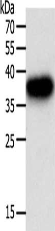 Gel: 10%SDS-PAGE, Lysate: 40 μg, Lane: A549 cells, Primary antibody: PLAUR Antibody(PLAUR Antibody) at dilution 1/400, Secondary antibody: Goat anti rabbit IgG at 1/8000 dilution, Exposure time: 3 secondsRabbit anti-Human PLAUR Polyclonal Antibody