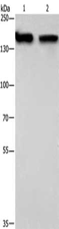 Gel: 6%SDS-PAGE, Lysate: 40 μg, Lane 1-2: 293T cells, hela cells, Primary antibody: NCAPD2 Antibody(NCAPD2 Antibody) at dilution 1/425, Secondary antibody: Goat anti rabbit IgG at 1/8000 dilution, Exposure time: 20 secondsRabbit anti-Human NCAPD2 Polyclonal Antibody