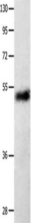 Gel: 10%SDS-PAGE, Lysate: 40 μg, Lane: Human seminoma tissue, Primary antibody: SLC2A1 Antibody(SLC2A1 Antibody) at dilution 1/850, Secondary antibody: Goat anti rabbit IgG at 1/8000 dilution, Exposure time: 10 minutesRabbit anti-Human SLC2A1 Polyclonal Antibody