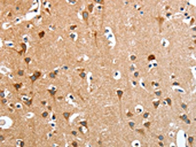 The image on the left is immunohistochemistry of paraffin-embedded Human brain tissue using the antibody Antibody) at dilution 1/50, on the right is treated with fusion protein. (Original magnification: ×200)Rabbit anti-Human ANKRD54 Polyclonal Antibody