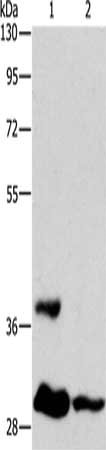 Gel: 10%SDS-PAGE, Lysate: 40 μg, Lane 1-2: Mouse testis tissue, human colon cancer tissue, Primary antibody: ANKRD54 Antibody(ANKRD54 Antibody) at dilution 1/250, Secondary antibody: Goat anti rabbit IgG at 1/8000 dilution, Exposure time: 10 secondsRabbit anti-Human ANKRD54 Polyclonal Antibody
