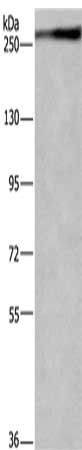 Gel: 6%SDS-PAGE, Lysate: 40 μg, Lane: Jurkat cells, Primary antibody: IGF2R Antibody(IGF2R Antibody) at dilution 1/400, Secondary antibody: Goat anti rabbit IgG at 1/8000 dilution, Exposure time: 3 minutesRabbit anti-Human IGF2R Polyclonal Antibody