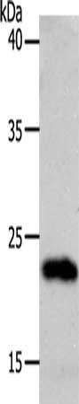 Gel: 10%SDS-PAGE, Lysate: 40 μg, Lane: 231 cells, Primary antibody: SOCS1 Antibody(SOCS1 Antibody) at dilution 1/1300, Secondary antibody: Goat anti rabbit IgG at 1/8000 dilution, Exposure time: 1 minuteRabbit anti-Human SOCS1 Polyclonal Antibody