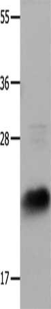 Gel: 12%SDS-PAGE, Lysate: 30 μg, Lane: Hela cells, Primary antibody: IL18 Antibody(IL18 Antibody) at dilution 1/1350, Secondary antibody: Goat anti rabbit IgG at 1/8000 dilution, Exposure time: 5 secondsRabbit anti-Human IL18 Polyclonal Antibody
