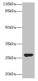 Western blot  | All lanes: IZUMO4 antibody at 2µg/ml + Rat gonadal tissue  | Secondary  | Goat polyclonal to rabbit IgG at 1/10000 dilution  | Predicted band size: 27, 25, 18, 19 kDa  | Observed band size: 27 kDa