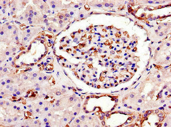 Immunohistochemistry of paraffin-embedded human kidney tissue using SWI5 Antibody at dilution of 1:100