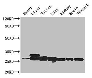 Western Blot | Positive WB detected in: Mouse heart tissue, Mouse liver tissue, Mouse spleen tissue, Mouse lung tissue, Mouse kidney tissue, Mouse brain tissue, Mouse stomach tissue | All lanes: SWI5 antibody at 3μg/ml | Secondary | Goat polyclonal to rabbit IgG at 1/50000 dilution | Predicted band size: 27 kDa | Observed band size: 27, 29 kDa
