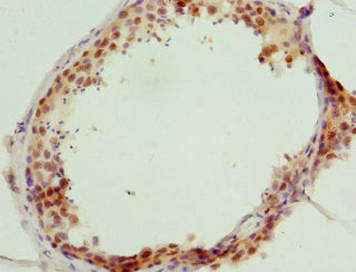 Immunohistochemistry of paraffin-embedded human testis tissue using GABPB1 Antibody at dilution of 1:100Rabbit anti-Human GABPB1 Polyclonal Antibody