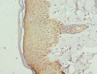 Immunohistochemistry of paraffin-embedded human skin tissue using GABPB1 Antibody at dilution of 1:100Rabbit anti-Human GABPB1 Polyclonal Antibody