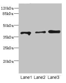 Western blot | All lanes: GABPB1antibody at 1.11μg/ml | Lane 1: Rat gonadal tissue | Lane 2: Hela whole cell lysate | Lane 3: HT29 whole cell lysate | Secondary | Goat polyclonal to rabbit IgG at 1/10000 dilution | Predicted band size: 43, 42, 39, 37 kDa | Observed band size: 43 kDaRabbit anti-Human GABPB1 Polyclonal Antibody