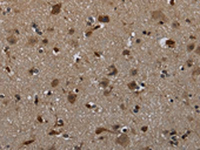 The image on the left is immunohistochemistry of paraffin-embedded Human brain  tissue using GLIPR1 Antibody(GLIPR1 Antibody) at dilution 1/60, on the right is treated with fusion protein. (Original magnification: ×200)Rabbit anti-Human GLIPR1 Polyclonal Antibody