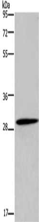 Gel: 10%SDS-PAGE, Lysate: 40 μg, Lane: Mouse kidney tissue, Primary antibody: GLIPR1 Antibody(GLIPR1 Antibody) at dilution 1/450, Secondary antibody: Goat anti rabbit IgG at 1/8000 dilution, Exposure time: 10 secondsRabbit anti-Human GLIPR1 Polyclonal Antibody