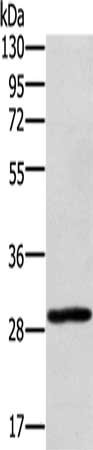 Gel: 8%SDS-PAGE, Lysate: 40 μg, Lane: 293T cells, Primary antibody: EDA2R Antibody(EDA2R Antibody) at dilution 1/450, Secondary antibody: Goat anti rabbit IgG at 1/8000 dilution, Exposure time: 10 secondsRabbit anti-Human EDA2R Polyclonal Antibody