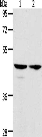 Gel: 10%SDS-PAGE, Lysate: 40 μg, Lane 1-2: Hela cells, A549 cells, Primary antibody: ACTL8 Antibody(ACTL8 Antibody) at dilution 1/350, Secondary antibody: Goat anti rabbit IgG at 1/8000 dilution, Exposure time: 5 seconds