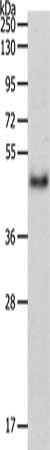Gel: 10%SDS-PAGE, Lysate: 60 μg, Lane: Mouse pancreas tissue, Primary antibody: PDK4 Antibody(PDK4 Antibody) at dilution 1/700, Secondary antibody: Goat anti rabbit IgG at 1/8000 dilution, Exposure time: 2 minutesRabbit anti-Human PDK4 Polyclonal Antibody