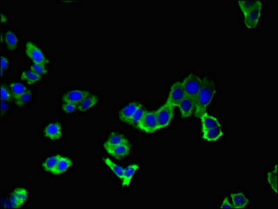 Immunofluorescent analysis of HepG2 cells using AAK1 Antibody at dilution of 1:100 and Alexa Fluor 488-congugated AffiniPure Goat Anti-Rabbit IgG(H+L)