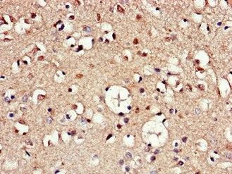 Immunohistochemistry of paraffin-embedded human brain tissue using AAK1 Antibody at dilution of 1:100