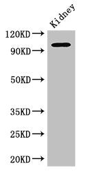 Western Blot | Positive WB detected in: Mouse kidney tissue | All lanes: AAK1 antibody at 2.5μg/ml | Secondary | Goat polyclonal to rabbit IgG at 1/50000 dilution | Predicted band size: 104, 94 kDa | Observed band size: 104 kDa