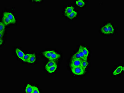Immunofluorescent analysis of HepG2 cells using C17orf58 Antibody at dilution of 1:100 and Alexa Fluor 488-congugated AffiniPure Goat Anti-Rabbit IgG(H+L)