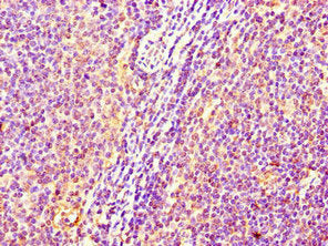 Immunohistochemistry of paraffin-embedded human lymph node tissue using the antibody at dilution of 1:100