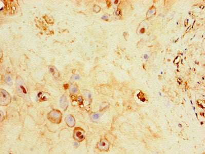 Immunohistochemistry of paraffin-embedded human placenta tissue using C17orf58 Antibody at dilution of 1:100