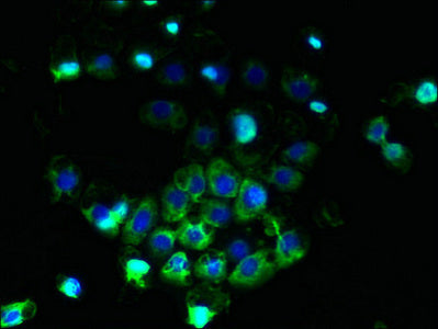 Immunofluorescent analysis of A431 cells using ABCB5 Antibody at dilution of 1:100 and Alexa Fluor 488-congugated AffiniPure Goat Anti-Rabbit IgG(H+L)