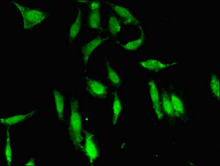Immunofluorescent analysis of Hela cells using PDS5A Antibody at dilution of 1:100 and Alexa Fluor 488-congugated AffiniPure Goat Anti-Rabbit IgG(H+L)Rabbit anti-Human PDS5A Polyclonal Antibody