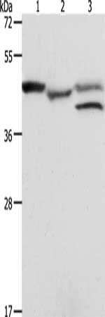 Gel: 10%SDS-PAGE, Lysate: 40 μg, Lane 1-3: K562 cells, mouse heart tissue, MCF7 cells, Primary antibody: PSMD6 Antibody(PSMD6 Antibody) at dilution 1/900, Secondary antibody: Goat anti rabbit IgG at 1/8000 dilution, Exposure time: 1 minuteRabbit anti-Human PSMD6 Polyclonal Antibody