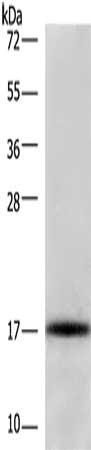 Gel: 6%SDS-PAGE, Lysate: 40 μg, Lane: Raji cells, Primary antibody: CDKN2C Antibody(CDKN2C Antibody) at dilution 1/325, Secondary antibody: Goat anti rabbit IgG at 1/8000 dilution, Exposure time: 40 secondsRabbit anti-Human CDKN2C Polyclonal Antibody