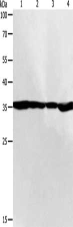 Gel: 10%SDS-PAGE, Lysate: 50 μg, Lane 1-4: 293T cells, SKOV3 cells, NIH/3T3 cells, 231 cells, Primary antibody: PSMD14 Antibody(PSMD14 Antibody) at dilution 1/200, Secondary antibody: Goat anti rabbit IgG at 1/8000 dilution, Exposure time: 1 minuteRabbit anti-Human PSMD14 Polyclonal Antibody