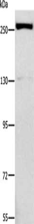 Gel: 6%SDS-PAGE, Lysate: 40 μg, Lane: Raji cells, Primary antibody: ESPL1 Antibody(ESPL1 Antibody) at dilution 1/500, Secondary antibody: Goat anti rabbit IgG at 1/8000 dilution, Exposure time: 1 secondRabbit anti-Human ESPL1 Polyclonal Antibody