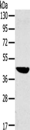 Gel: 8%SDS-PAGE, Lysate: 40 μg, Lane: Mouse liver tissue, Primary antibody: MAPK12 Antibody(MAPK12 Antibody) at dilution 1/350, Secondary antibody: Goat anti rabbit IgG at 1/8000 dilution, Exposure time: 5 seconds