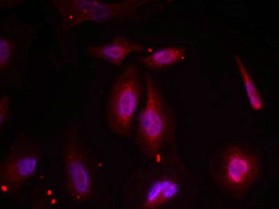 Immunofluorescence staining of methanol-fixed Hela cells using ATF2(Phospho-Thr69 or 51) Antibody.Rabbit anti-Human ATF2 Polyclonal Antibody