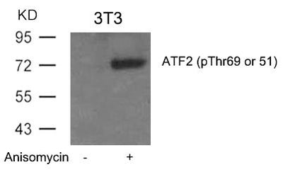 Western blot analysis of extracts from 3T3 cells untreated or treated with Anisomycin using ATF2(Phospho-Thr69 or 51) Antibody.