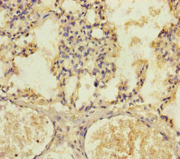 Immunohistochemistry of paraffin-embedded human lung tissue using KIZ Antibody at dilution of 1:100