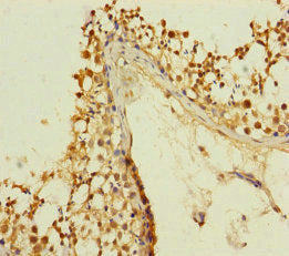 Immunohistochemistry of paraffin-embedded human testis tissue using KIZ Antibody at dilution of 1:100
