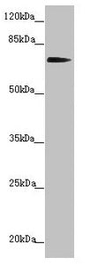 Western blot  | All lanes: KIZ antibody at 2.41µg/ml + Hela whole cell lysate  | Secondary  | Goat polyclonal to rabbit IgG at 1/10000 dilution  | Predicted band size: 76, 63, 70, 74, 60 kDa  | Observed band size: 76 kDa