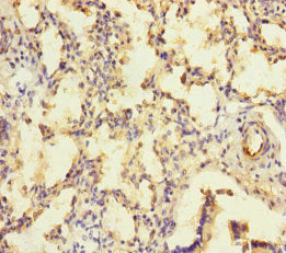 Immunohistochemistry of paraffin-embedded human lung tissue using KIZ Antibody at dilution of 1:100