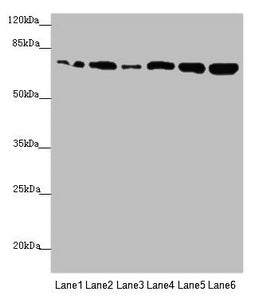 Western blot  | All lanes: KIZ antibody at 2.89µg/ml  | Lane 1: HepG2 whole cell lysate  | Lane 2: A549 whole cell lysate  | Lane 3: CEM whole cell lysate  | Lane 4: Hela whole cell lysate  | Lane 5: Jurkat whole cell lysate  | Lane 6: 293T whole cell lysate  | Secondary  | Goat polyclonal to rabbit IgG at 1/10000 dilution  | Predicted band size: 76, 63, 70, 74, 60 kDa  | Observed band size: 76 kDa
