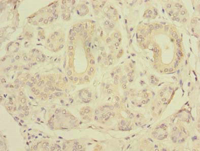 Immunohistochemistry of paraffin-embedded human salivary gland tissue using SLC4A8 Antibody at dilution of 1:100Rabbit anti-Human SLC4A8 Polyclonal Antibody
