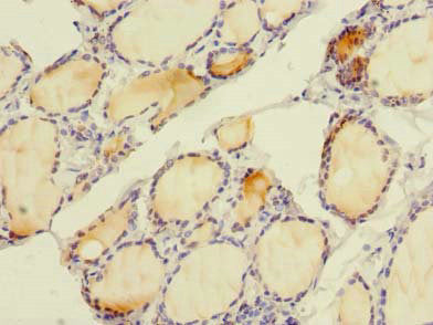 Immunohistochemistry of paraffin-embedded human thyroid tissue using SLC4A8 Antibody at dilution of 1:100Rabbit anti-Human SLC4A8 Polyclonal Antibody