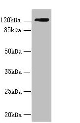 Western blot  | All lanes: SLC4A8 antibody at 2µg/ml + Hela whole cell lysate  | Secondary  | Goat polyclonal to rabbit IgG at 1/10000 dilution  | Predicted band size: 123, 121, 118, 112, 78, 84, 72 kDa  | Observed band size: 123 kDaRabbit anti-Human SLC4A8 Polyclonal Antibody